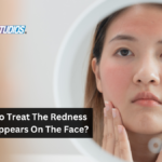 How To Treat The Redness That Appears On The Face?